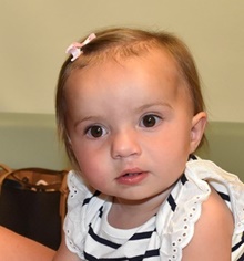 Cleft Lip and Palate Repair After Photo by Rachel Ruotolo, MD; Garden City, NY - Case 42479