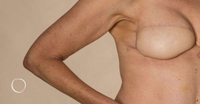 using your own tissue to restore your breasts